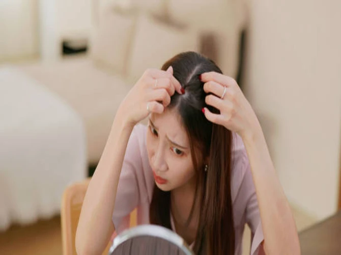 Receding Hairline: Causes, Impact, and Solutions