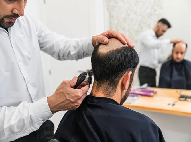 Good Haircuts for Receding Hairlines: Style & Confidence Boost